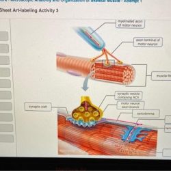 Exercise 12 microscopic anatomy and organization of skeletal muscle