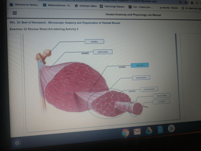 Exercise 12 microscopic anatomy and organization of skeletal muscle